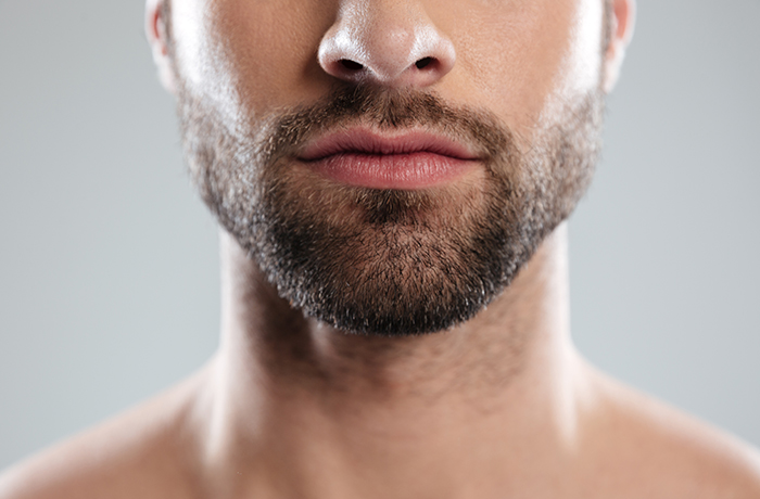 Beard and Mustache Transplant Kochi
